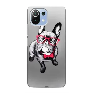 Чехол (ТПУ) Милые собачки для Xiaomi Mi 11 Lite (Бульдог в очках)