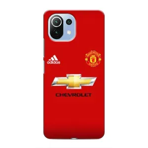 Силиконовые Чехлы принт Футбол на Xiaomi Mi 11 Lite (Man United)