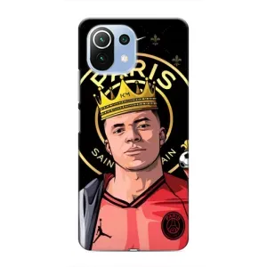 Чохол (TPU) з Футболістом на Xiaomi Mi 11 Lite (Mbappe King)