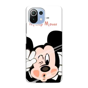 Чехлы для телефонов Xiaomi Mi 11 Lite - Дисней (Mickey Mouse)