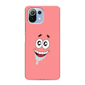Чехлы с Патриком на Xiaomi Mi 11 Lite (Мордочка Патрика)