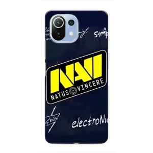 Чехол КИБЕРСПОРТ для Xiaomi Mi 11 Lite (NAVI)
