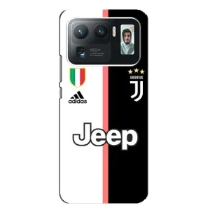 Чехлы с ТОП Футбольными клубами на Xiaomi Mi 11 Ultra (Juventus)