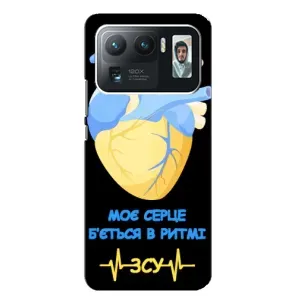 ЗСУ Чехлы (TPU) для Xiaomi Mi 11 Ultra (Ритм ЗСУ)