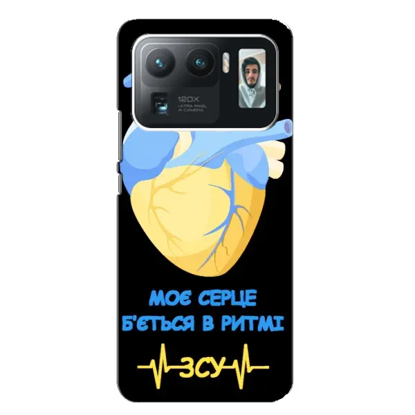 Чехол с рисунком «Ритм ЗСУ» для Xiaomi Mi 11 Ultra Чехол с рисунком «Ритм ЗСУ» для Xiaomi Mi 11 Ultra