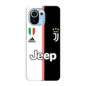 Чехлы с ТОП Футбольными клубами на Xiaomi Mi 11 (Juventus)