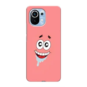 Чехлы с Патриком на Xiaomi Mi 11 (Мордочка Патрика)