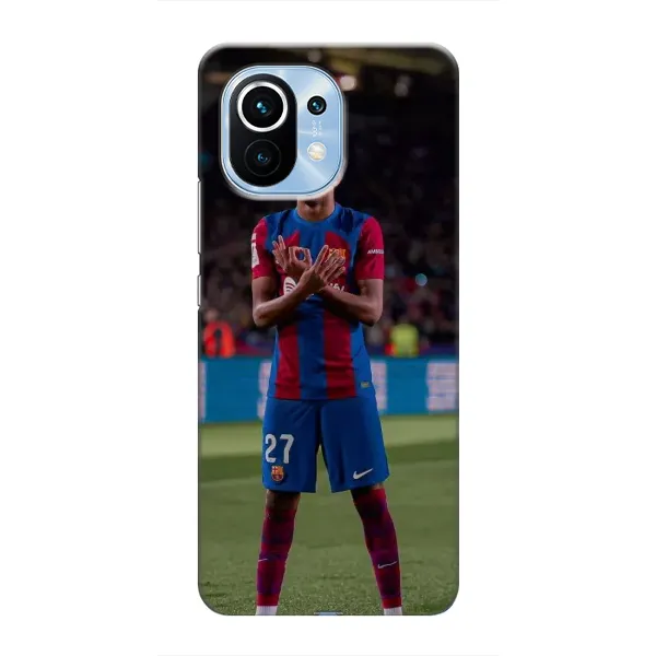 Чехол с рисунком «Ямаль» для Xiaomi Mi 11 Чехол с рисунком «Ямаль» для Xiaomi Mi 11