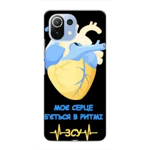 ЗСУ Чохли (TPU) для Xiaomi Mi 11i (Ритм ЗСУ)