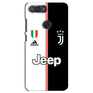Чохоли з ТОР футбольними клубами на Xiaomi Mi 8 Lite (Juventus)