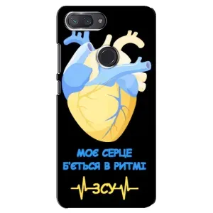 ЗСУ Чехлы (TPU) для Xiaomi Mi 8 Lite (Ритм ЗСУ)