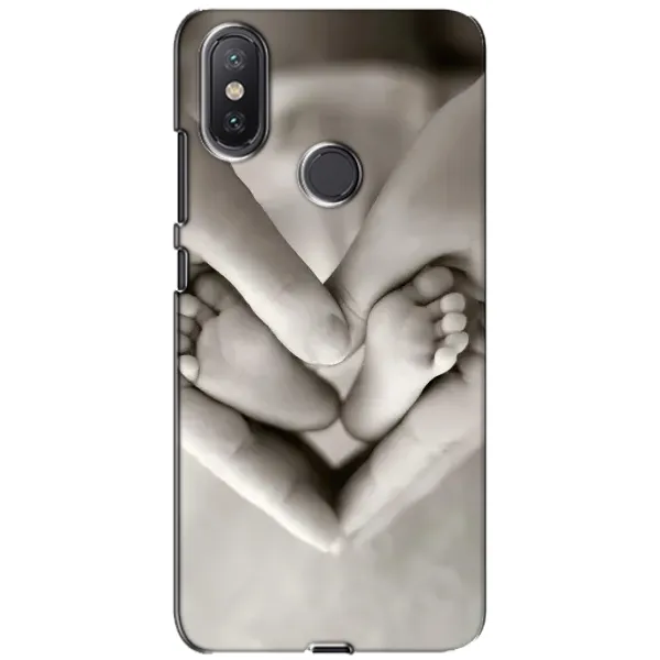Чехол с рисунком «Любящие руки» для Xiaomi Mi A2 Lite Чехол с рисунком «Любящие руки» для Xiaomi Mi A2 Lite