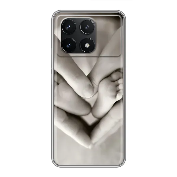 Чехол с рисунком «Любящие руки» для Xiaomi POCO F6 Pro Чехол с рисунком «Любящие руки» для Xiaomi POCO F6 Pro