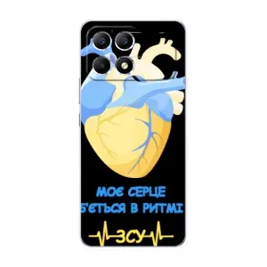 ЗСУ Чехлы (TPU) для Xiaomi POCO F6 (Ритм ЗСУ)