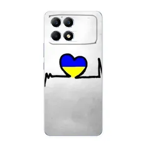 Силиконовый Чехол на Xiaomi POCO F6 (Я-Украина) (Украинская кардиограмма)