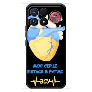 ЗСУ Чехлы (TPU) для Xiaomi Poco F9 Ultra (Ритм ЗСУ)