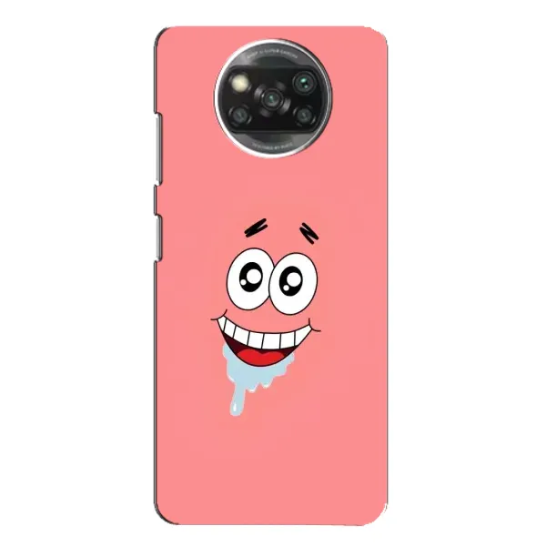 Чехол с рисунком «Мордочка Патрика» для Xiaomi POCO X3 Pro