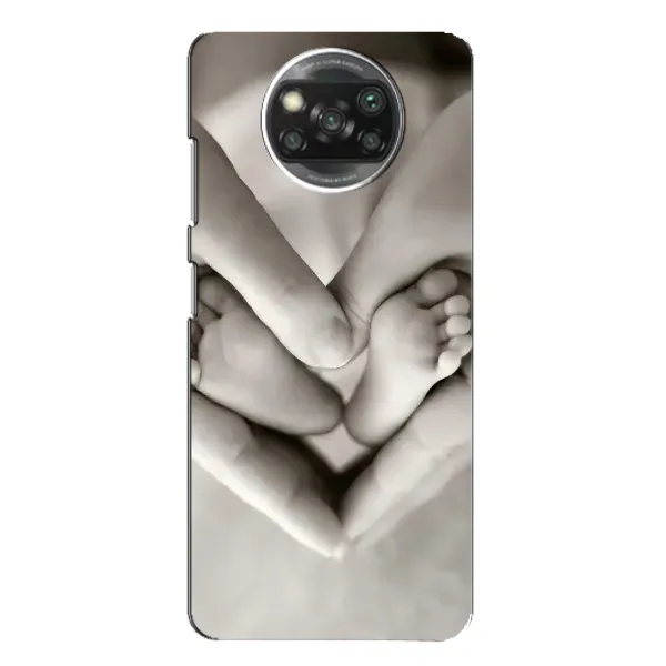 Чохол з малюнком «Люблячі долоні» для Xiaomi POCO X3 Чохол з малюнком «Люблячі долоні» для Xiaomi POCO X3