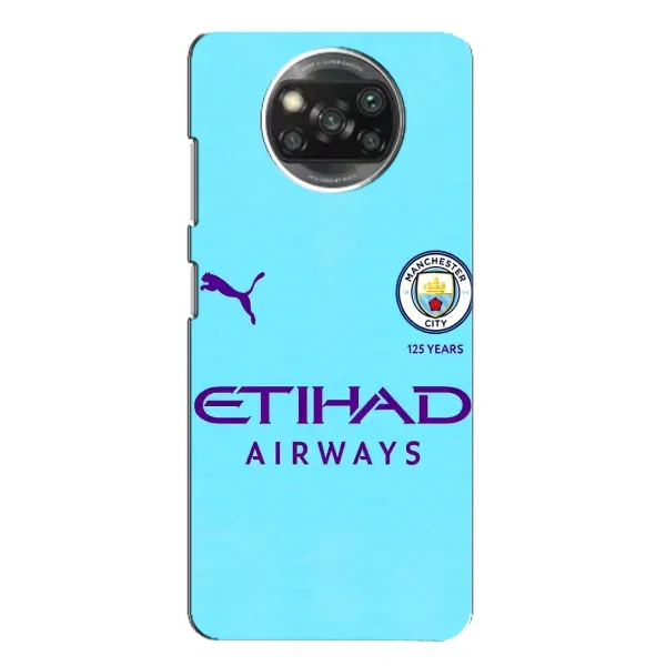 Чехол с рисунком «Man City» для Xiaomi POCO X3 Чехол с рисунком «Man City» для Xiaomi POCO X3