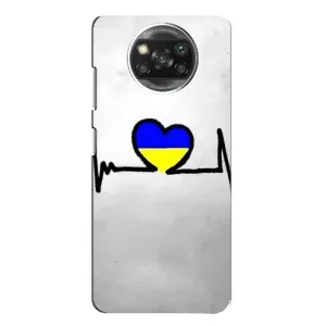 Силиконовый Чехол на Xiaomi POCO X3 (Я-Украина) (Украинская кардиограмма)