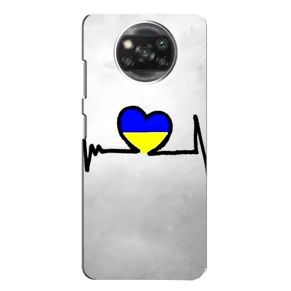 Чехол с рисунком «Украинская кардиограмма» для Xiaomi POCO X3 Чехол с рисунком «Украинская кардиограмма» для Xiaomi POCO X3