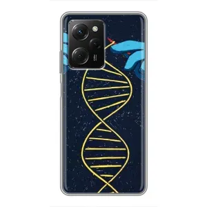 Чохли з сенсом на Xiaomi POCO X5 Pro (5G) (Життя)
