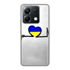 Силиконовый Чехол на Xiaomi POCO X6 5G (Я-Украина) (Украинская кардиограмма)