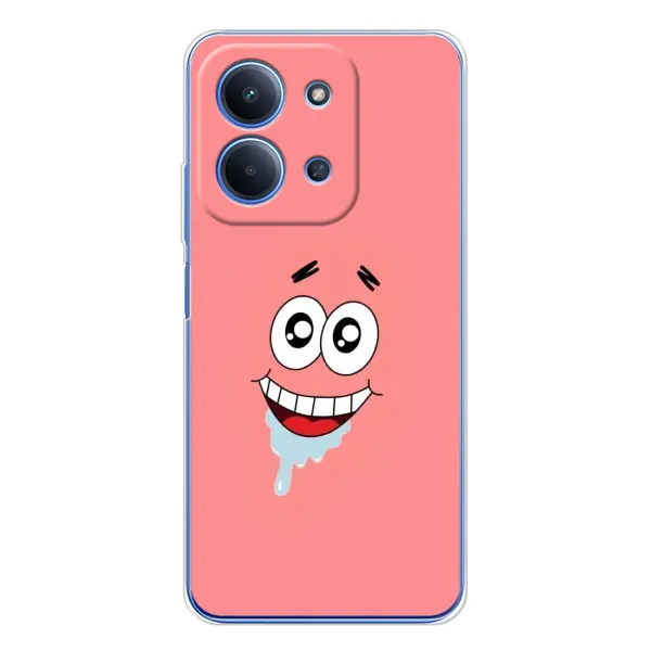Чехол с рисунком «Мордочка Патрика» для Xiaomi Redmi 15C 5g Чехол с рисунком «Мордочка Патрика» для Xiaomi Redmi 15C 5g