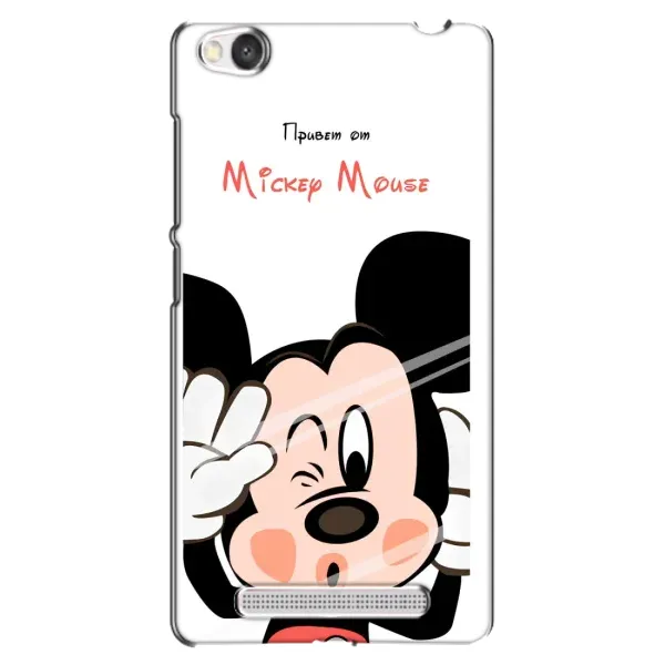 Чехол с рисунком «Mickey Mouse» для Xiaomi Redmi 4A Чехол с рисунком «Mickey Mouse» для Xiaomi Redmi 4A