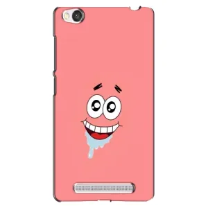 Чехлы с Патриком на Xiaomi Redmi 4A (Мордочка Патрика)