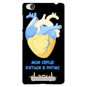 ЗСУ Чехлы (TPU) для Xiaomi Redmi 4A (Ритм ЗСУ)
