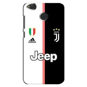 Чехлы с ТОП Футбольными клубами на Xiaomi Redmi 4X (Juventus)