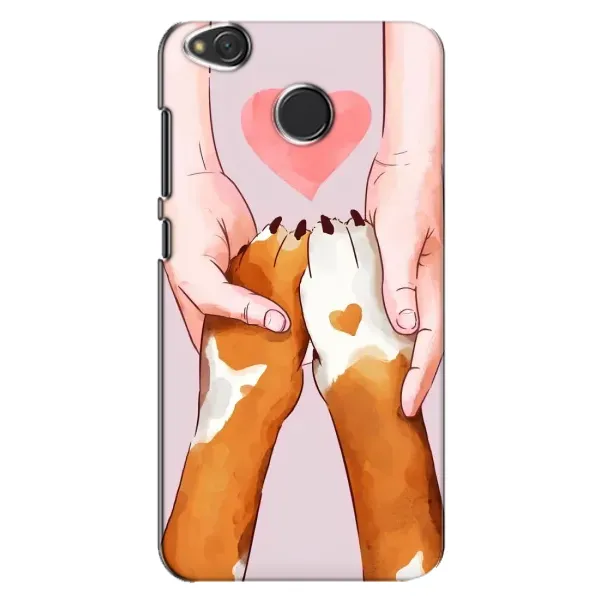 Чехол с рисунком «Любовь к собакам» для Xiaomi Redmi 4X Чехол с рисунком «Любовь к собакам» для Xiaomi Redmi 4X