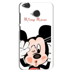 Чехлы для телефонов Xiaomi Redmi 4X - Дисней (Mickey Mouse)