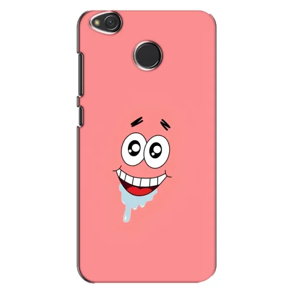 Чехол с рисунком «Мордочка Патрика» для Xiaomi Redmi 4X Чехол с рисунком «Мордочка Патрика» для Xiaomi Redmi 4X