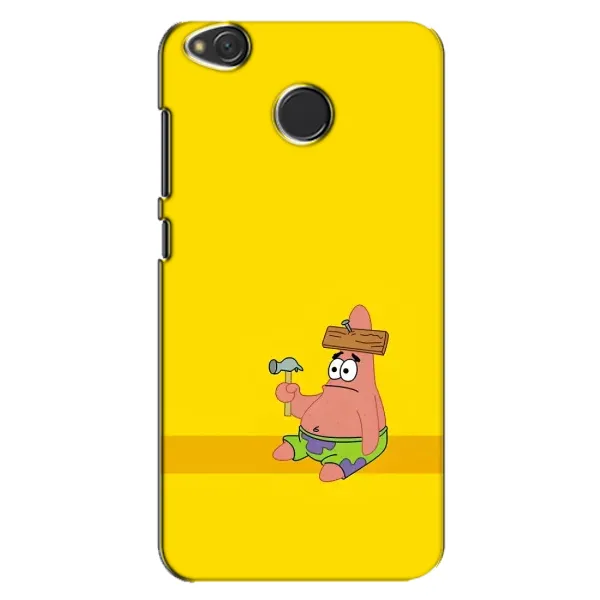 Чехол с рисунком «Ошибочка» для Xiaomi Redmi 4X Чехол с рисунком «Ошибочка» для Xiaomi Redmi 4X