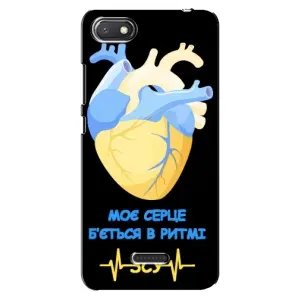 ЗСУ Чехлы (TPU) для Xiaomi Redmi 6A