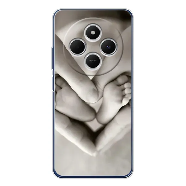 Чехол с рисунком «Любящие руки» для Xiaomi Redmi A4 5G Чехол с рисунком «Любящие руки» для Xiaomi Redmi A4 5G
