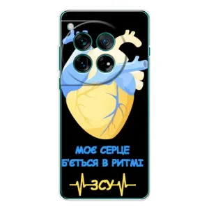 ЗСУ Чехлы (TPU) для Xiaomi Redmi K90 Pro Max (Ритм ЗСУ)