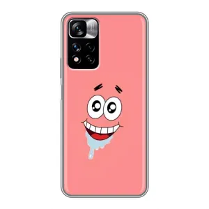 Чохли з Патріком на Xiaomi Redmi Note 11 Pro Plus (Мордочка Патріка)