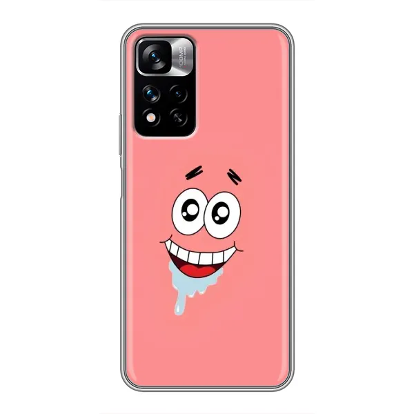 Чехол с рисунком «Мордочка Патрика» для Xiaomi Redmi Note 11 Pro Plus Чехол с рисунком «Мордочка Патрика» для Xiaomi Redmi Note 11 Pro Plus