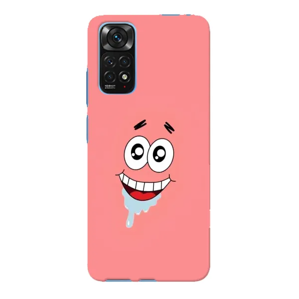 Чохол з малюнком «Мордочка Патріка» для Xiaomi Redmi Note 11E Pro Чохол з малюнком «Мордочка Патріка» для Xiaomi Redmi Note 11E Pro