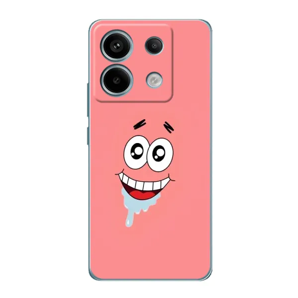 Чехол с рисунком «Мордочка Патрика» для Xiaomi Redmi Note 13 Pro Чехол с рисунком «Мордочка Патрика» для Xiaomi Redmi Note 13 Pro