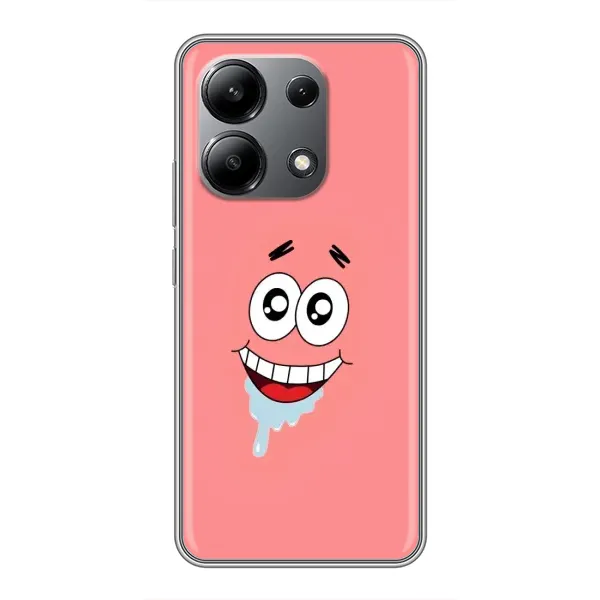 Чехол с рисунком «Мордочка Патрика» для Xiaomi Redmi Note 13 (4G)