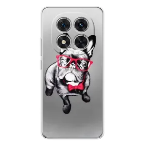 Чехол (ТПУ) Милые собачки для Xiaomi Redmi Note 14 Pro Plus (Бульдог в очках)