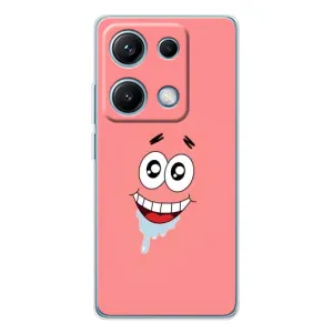 Чехлы с Патриком на Xiaomi Redmi Note 14S (Мордочка Патрика)