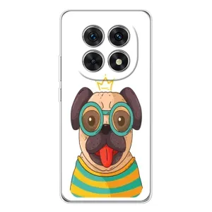 Бампер для Xiaomi Redmi Note 15 5G з картинкою "Песики" (Собака Король)