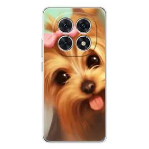 Чохол (ТПУ) Милі песики для Xiaomi Redmi Note 15 5G (Йоркширський тер'єр)
