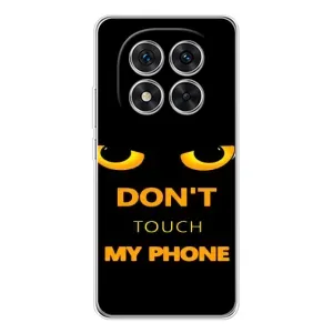 Чохол з Прикольним Принтом на Xiaomi Redmi Note 15 Pro 5G (Не чіпай мій телефон)