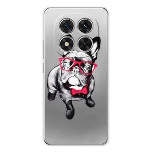 Чохол (ТПУ) Милі песики для Xiaomi Redmi Note 15 Pro Plus (Бульдог в окулярах)